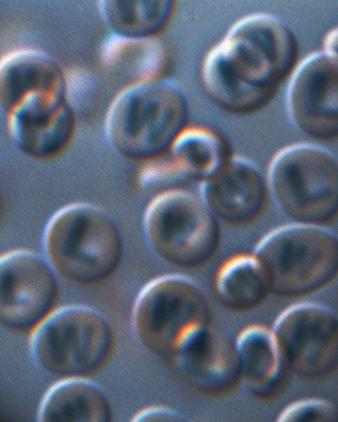 A microscope view of blurred, overlapping cells, each one stamped with a W or an L.